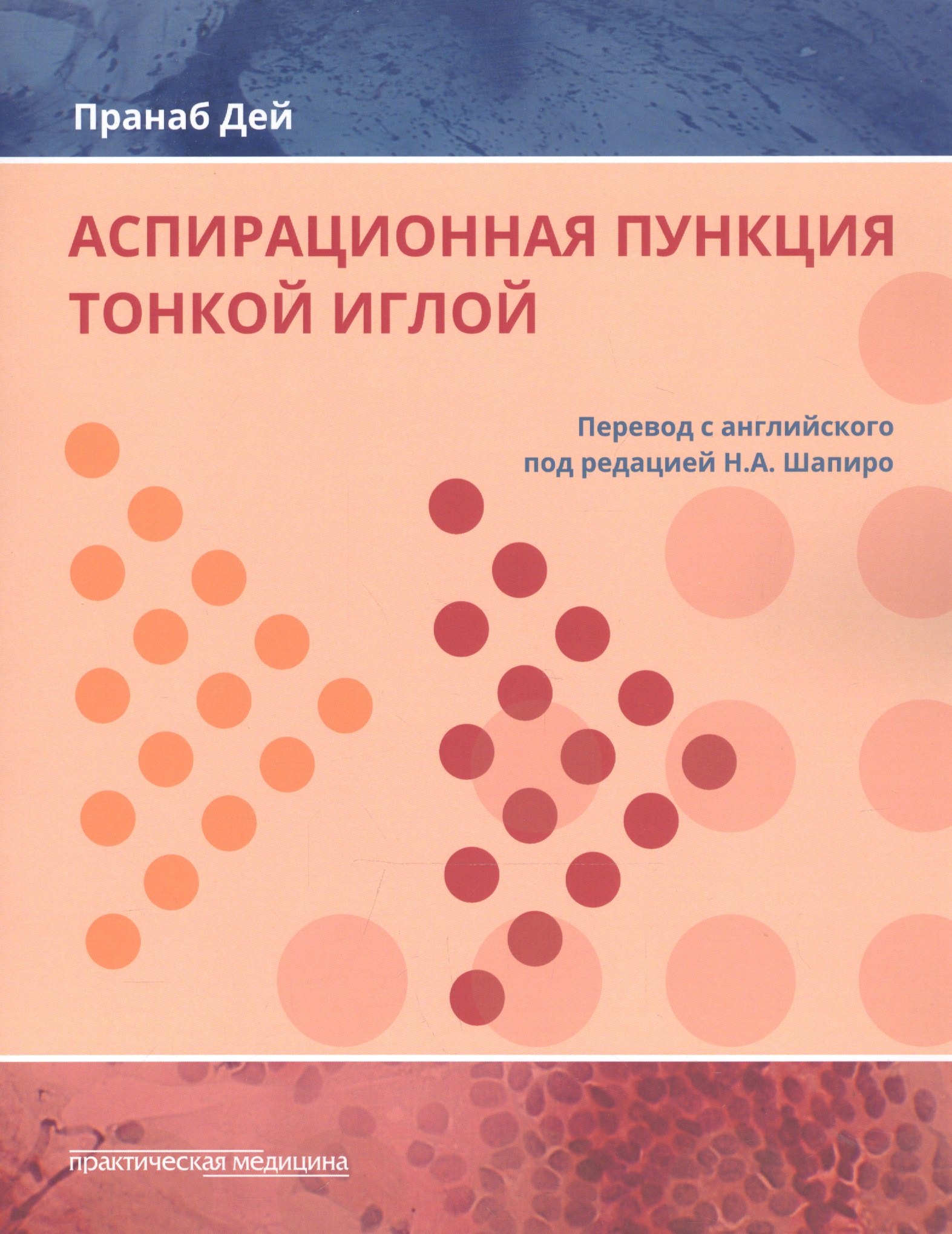Аспирационная пункция тонкой иглой Трактовка результатов и диагност. проблемы (Дей)
Аспирационная пункция тонкой иглой Трактовка результатов и диагност. проблемы (Дей)