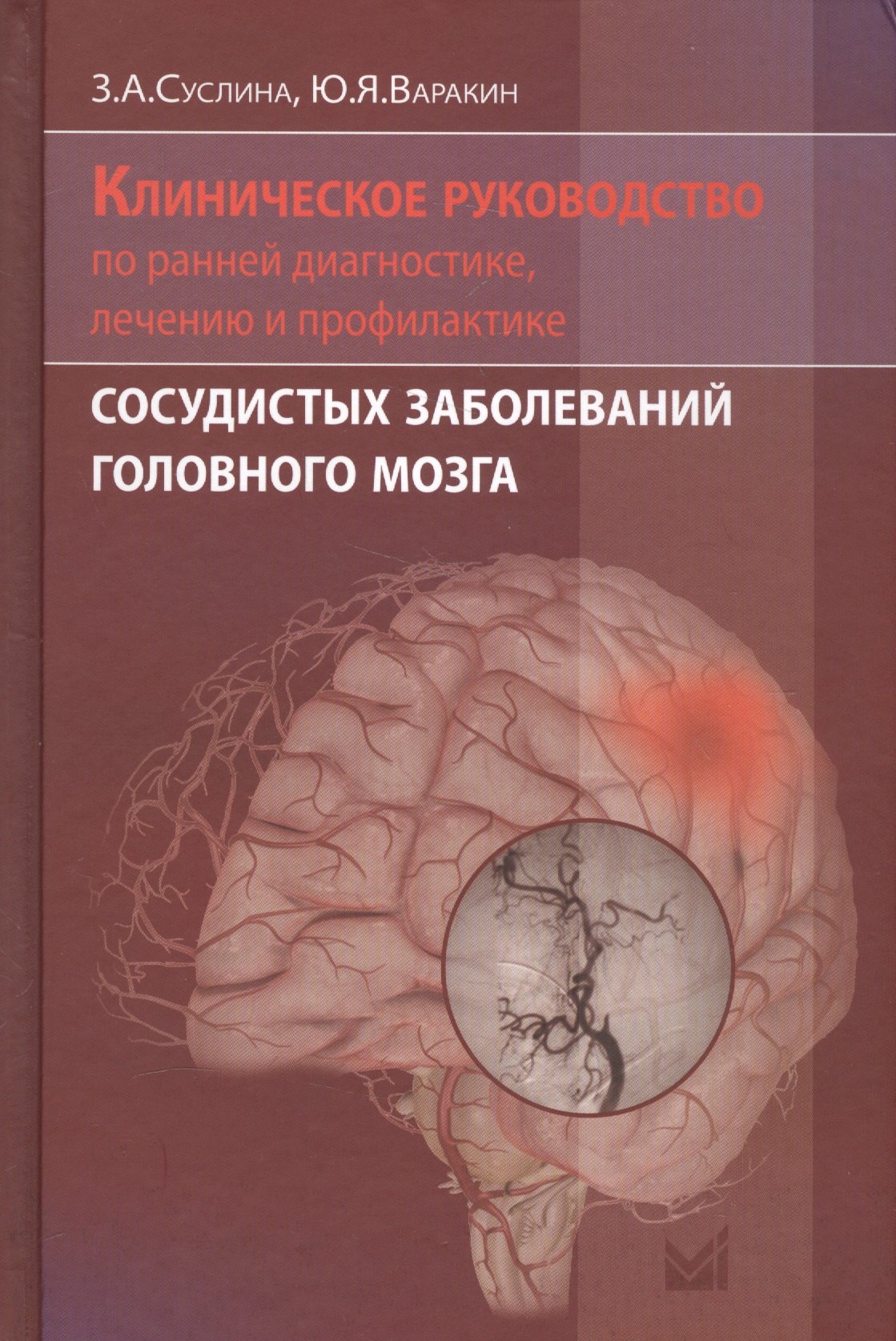 Клиническое руководство по ранней диагностике, лечению и профилактике сосудистых заболеваний головного мозга
Клиническое руководство по ранней диагностике, лечению и профилактике сосудистых заболеваний головного мозга