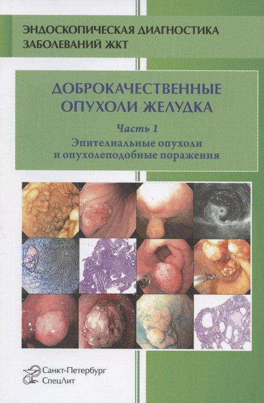 Доброкачественные опухоли желудка. Эпителиальные опухоли и опухолеподобные поражения. Часть 1. Учебно-методическое пособие
Доброкачественные опухоли желудка. Эпителиальные опухоли и опухолеподобные поражения. Часть 1. Учебно-методическое пособие