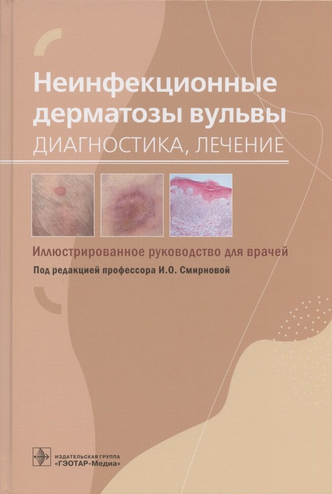 Неинфекционные дерматозы вульвы: диагностика, лечение. Иллюстрированное руководство для врачей
Неинфекционные дерматозы вульвы: диагностика, лечение. Иллюстрированное руководство для врачей