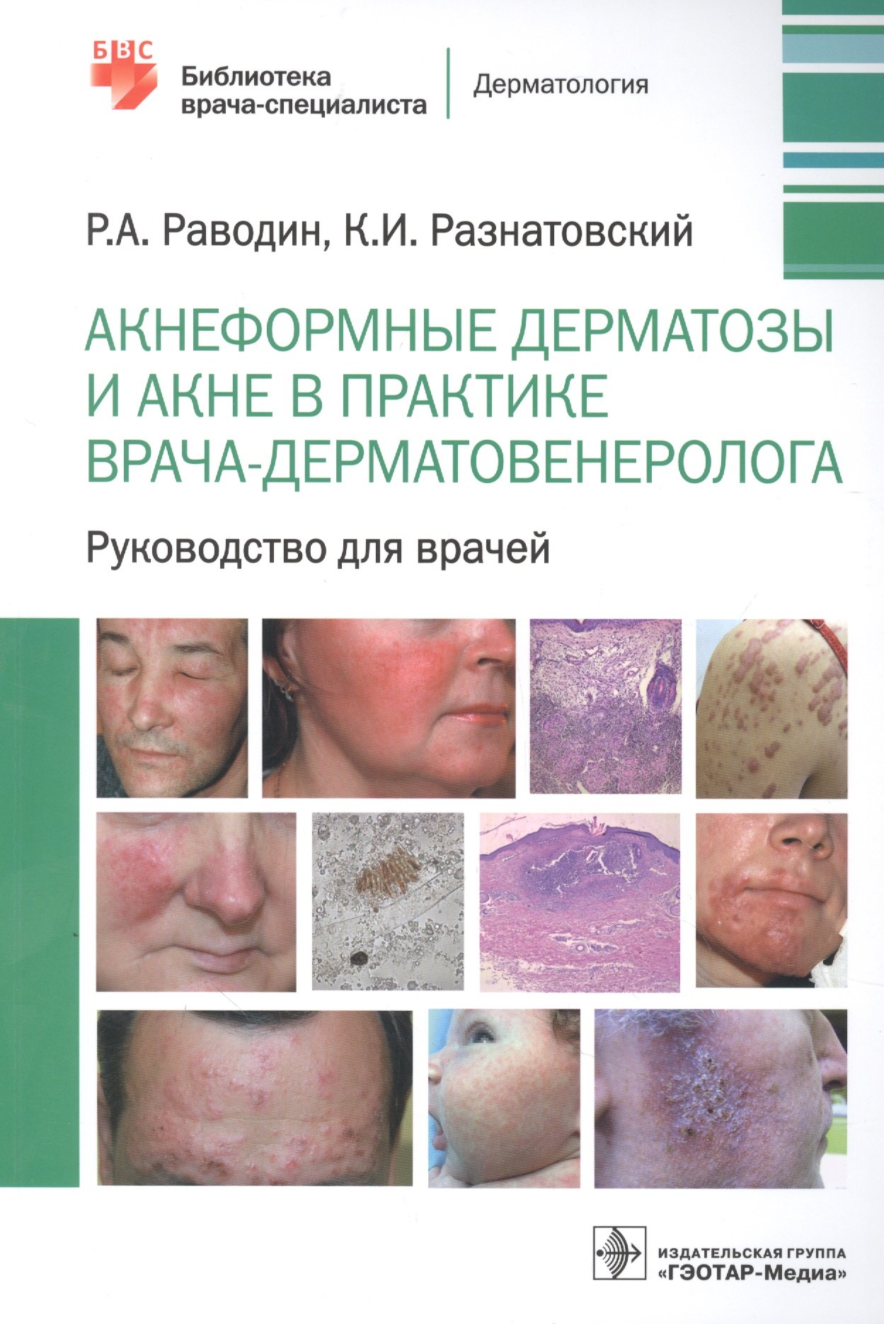 Акнеформные дерматозы и акне в практике врача-дерматовенеролога: руководство для врачей
Акнеформные дерматозы и акне в практике врача-дерматовенеролога: руководство для врачей