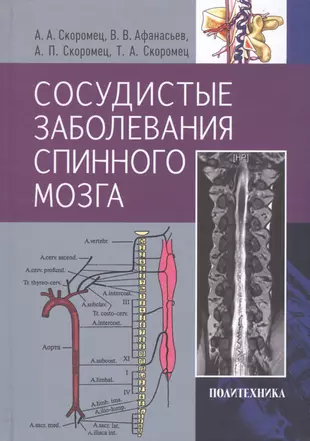 Сосудистые заболевания спинного мозга. Руководство для врачей — 2744227 — 1