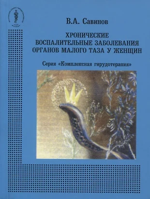 Воспалительные заболевания органов малого таза презентация