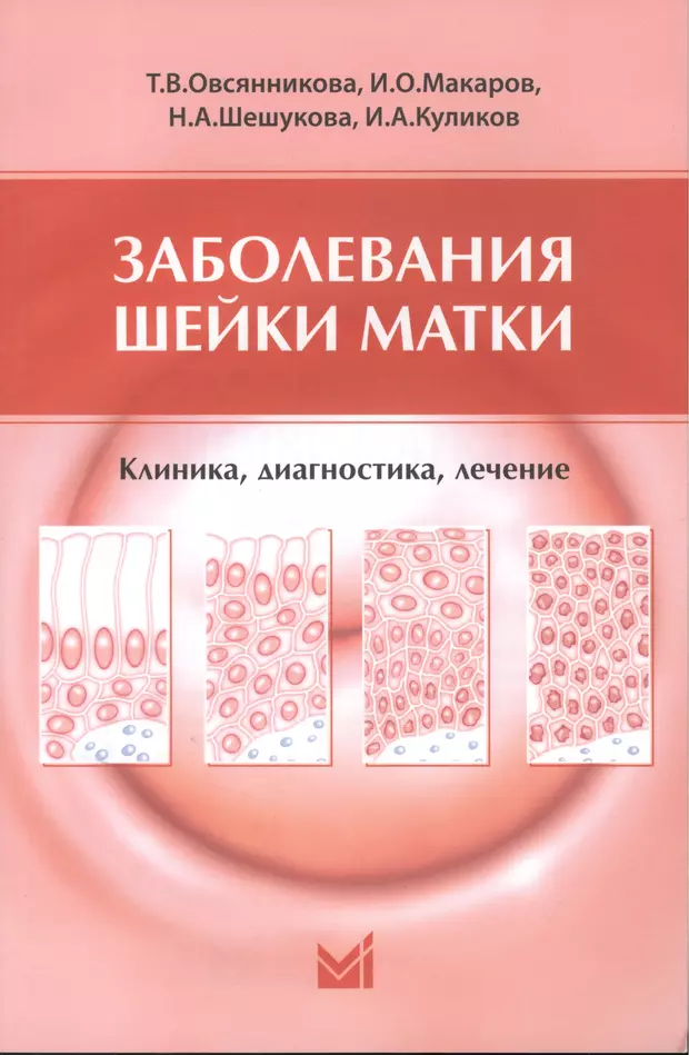 Заболевание шейки. Заболевания шейки матки. Заболевания шейки матки книга. Заболевания шейки матки клиника. Заболевания шейки матки гинекология.