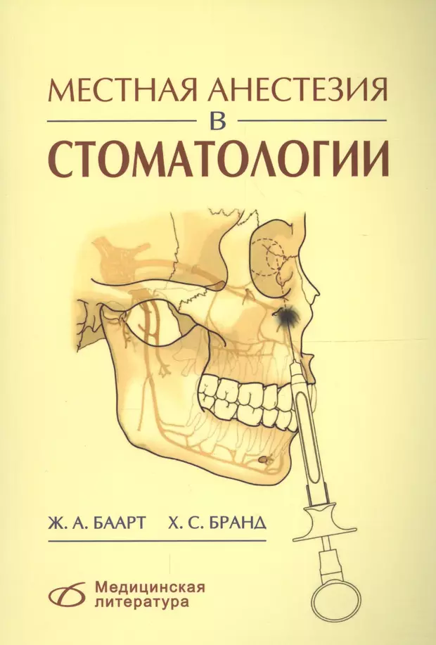 Анестезия в стоматологии. Баарт анестезия в стоматологии. Местная анестезия в стоматологии книга. Местная анестезия в стоматологии Баарт Бранд. Местное обезболивание в стоматологии.