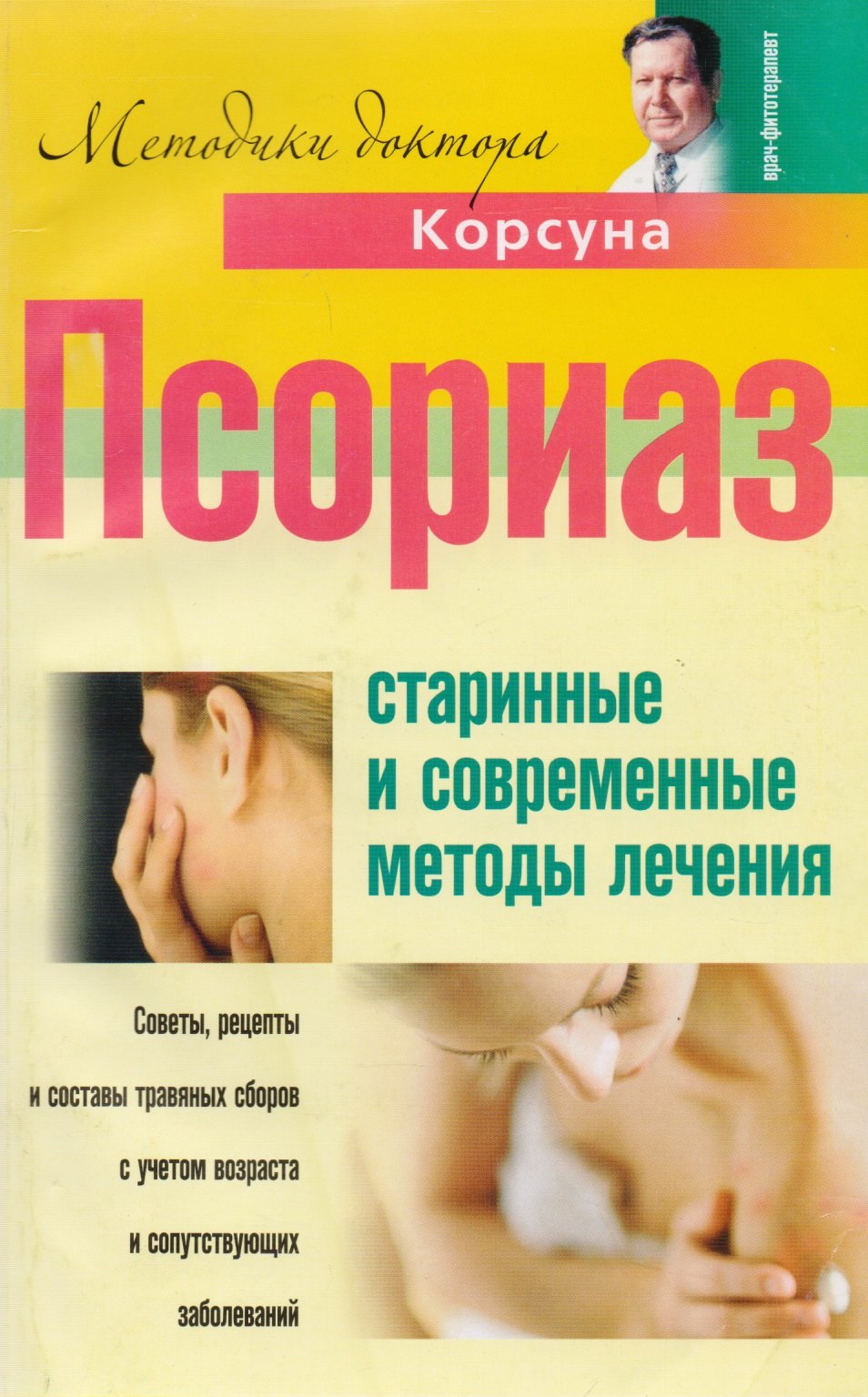 

Псориаз. Старинные и современные методы лечения