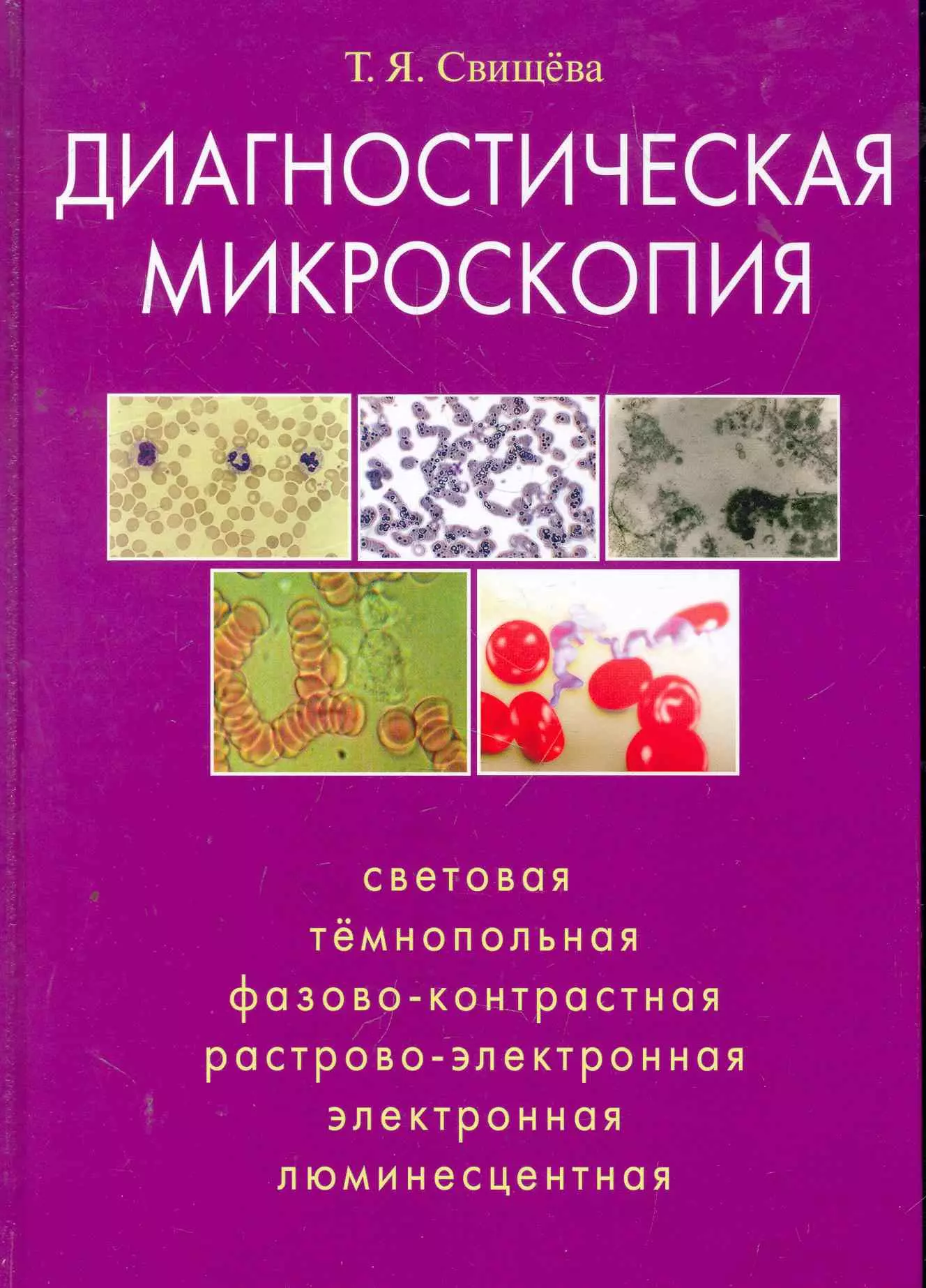 Свищева Тамара Яковлевна - Диагностическая микроскопия: световая, тёмнопольная, фазово-контрольная, растрово-электронная, люминесцентная.