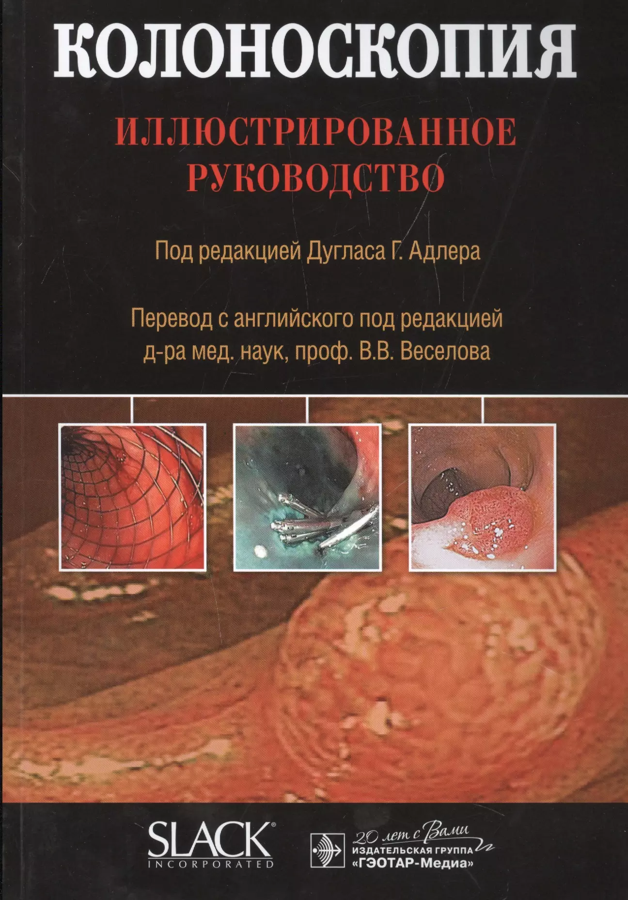 Колоноскопия отзывы. Колоноскопия иллюстрированное руководство Дуглас. Колоноскопия : иллюстрированное руководство - Дуглас г. Адлер.