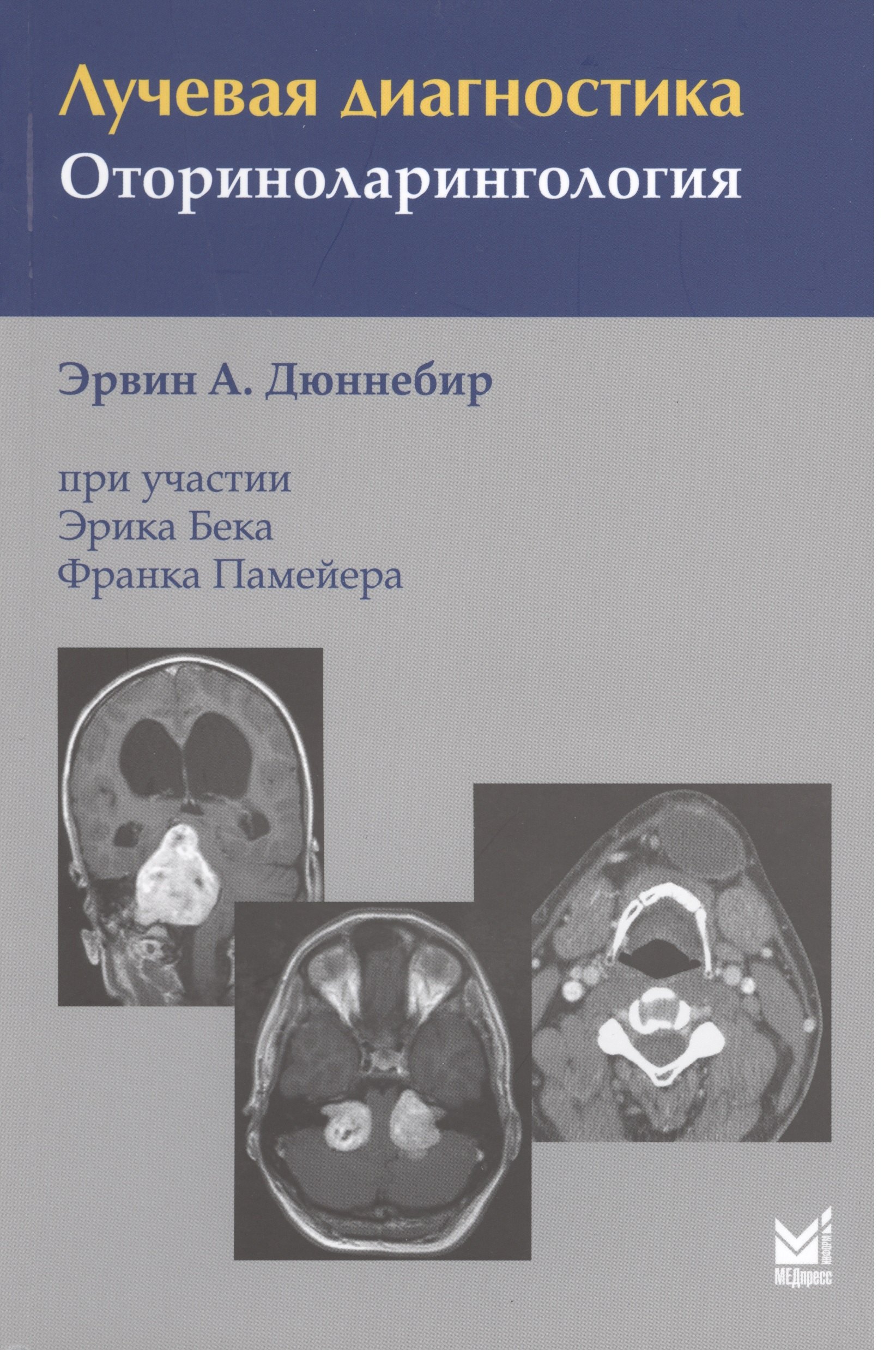 

Лучевая диагностика. Оториноларингология