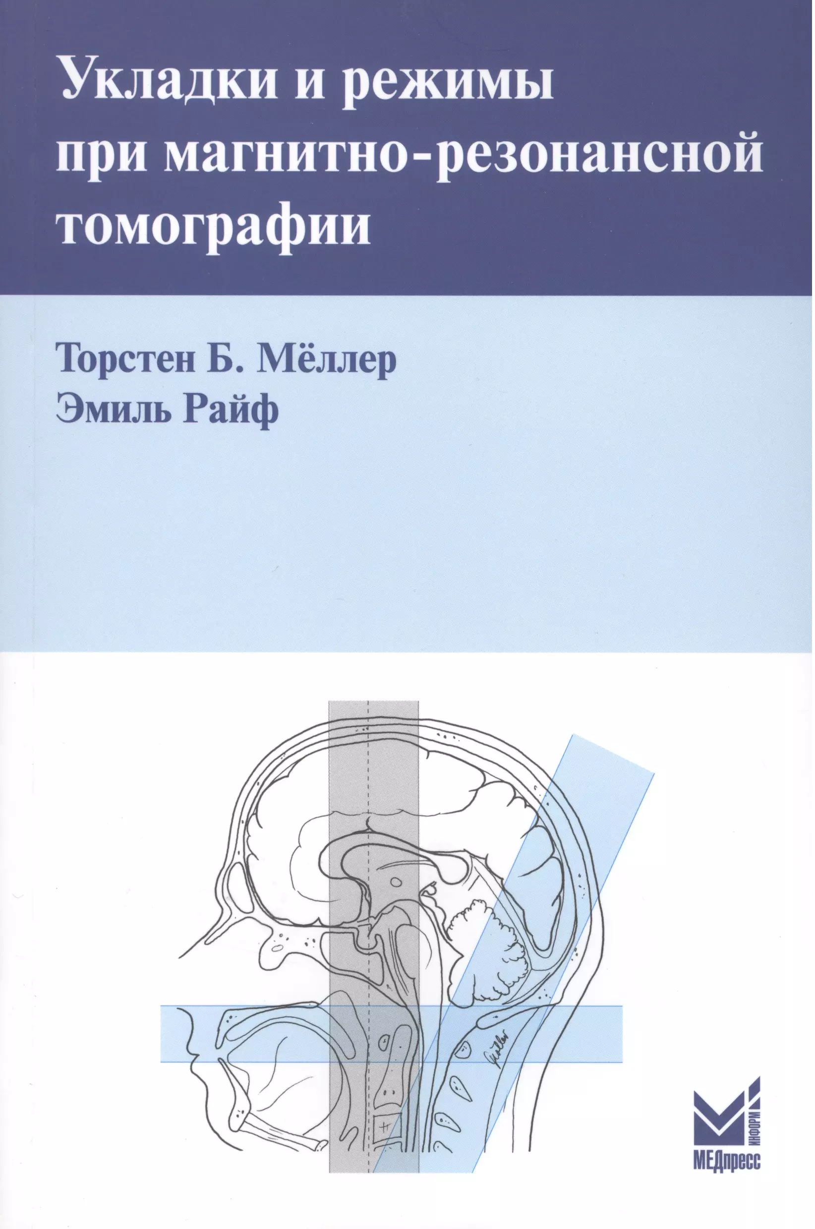 Меллер Торстен Б. - Укладки и режимы при магнитно-резонансной томографии.