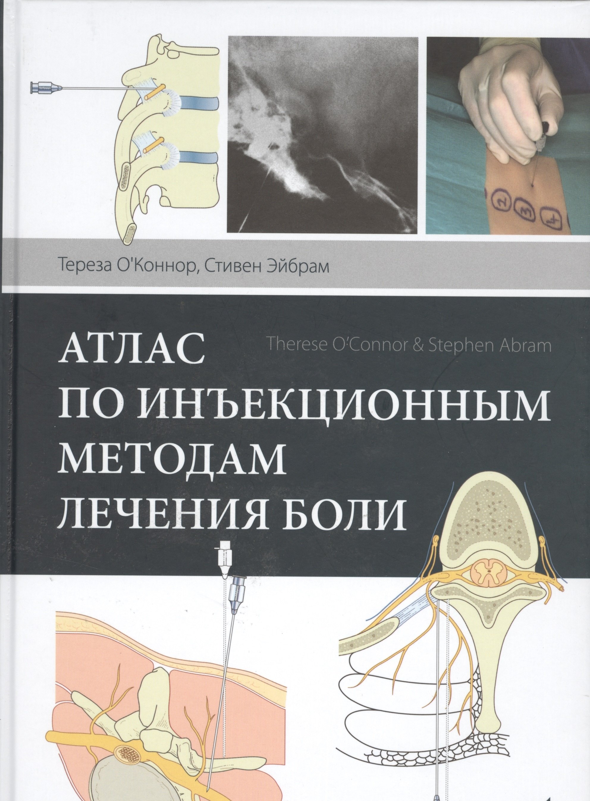 

Атлас по инъекционным методам лечения боли