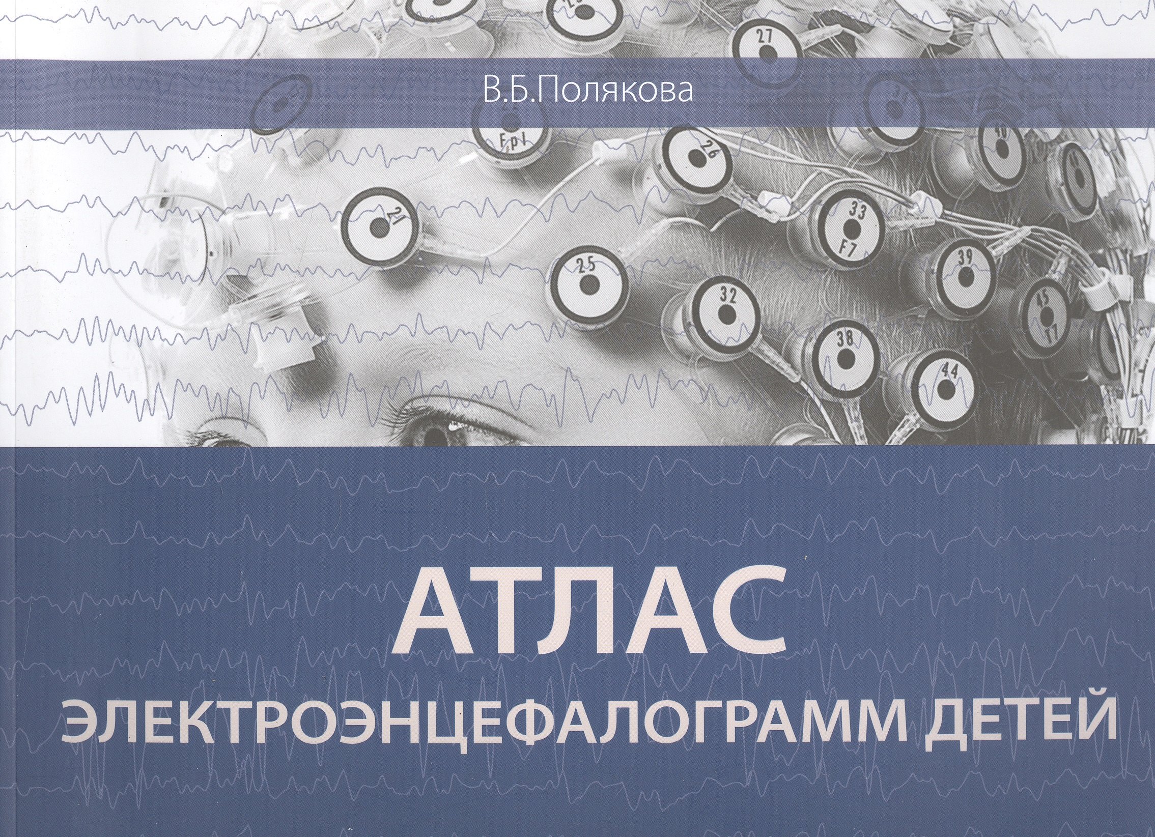 

Атлас электроэнцефалограмм детей
