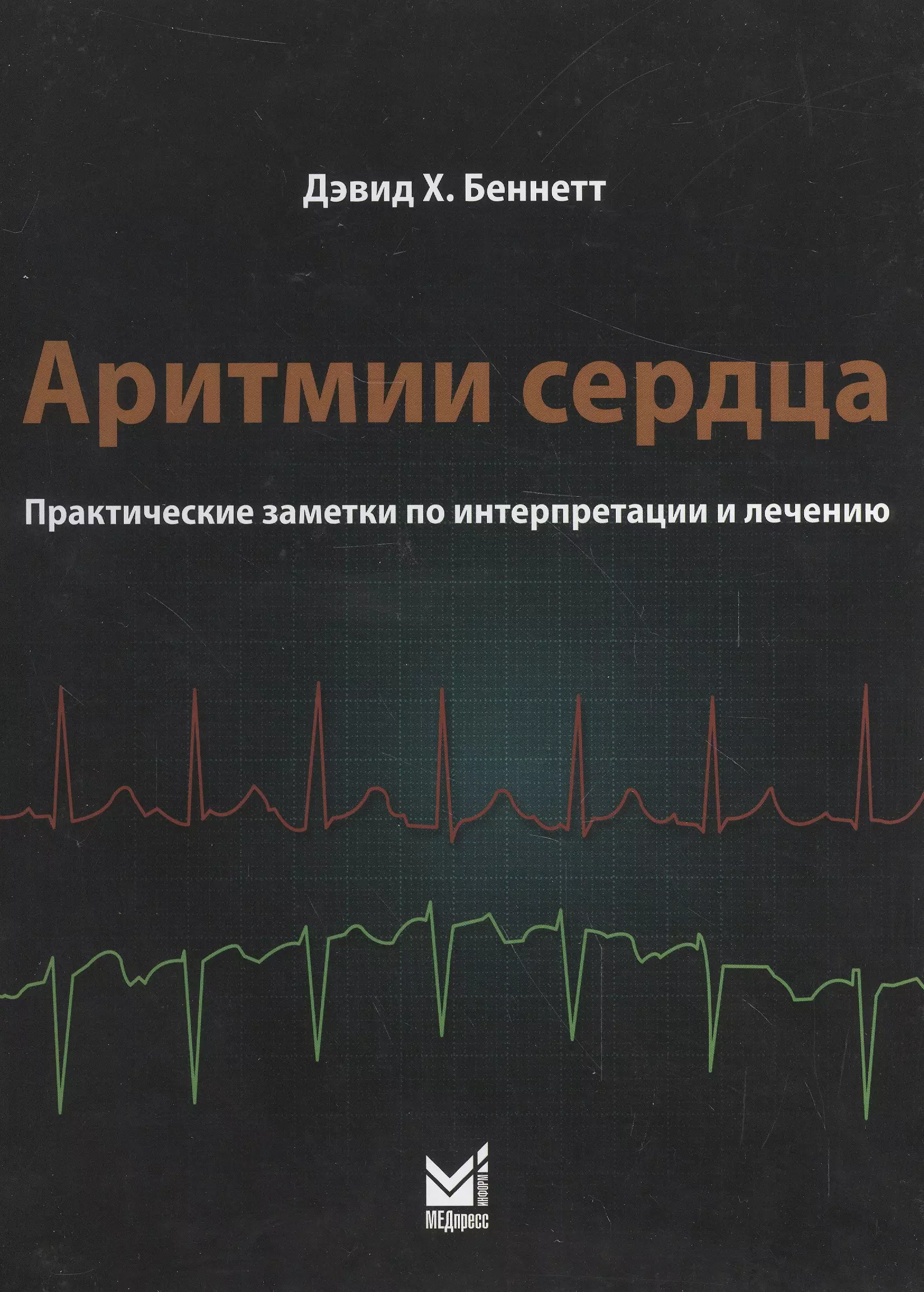 Сердечный практический. Кушаковский аритмии сердца. Арифмея. Дэвид Беннетт аритмии сердца. Архитомия.