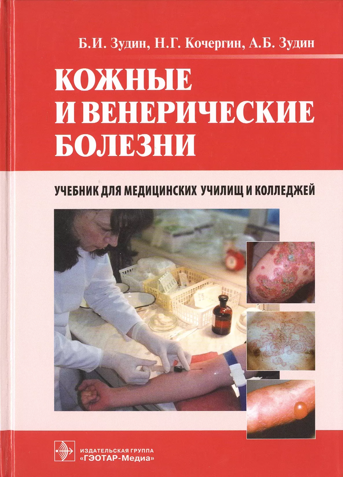 Зудин Борис Иванович - Кожные и венерические болезни. 2-е изд.