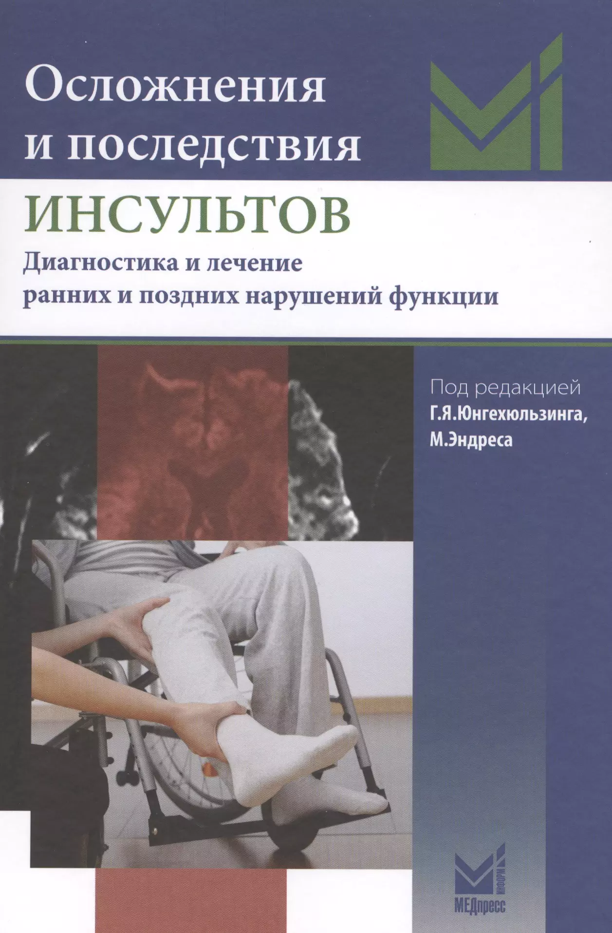 Поздние нарушения. Осложнения инсульта. Инсульт осложнения и последствия. Осложнения инсульта ранние и поздние. Ранняя диагностика инсульта.