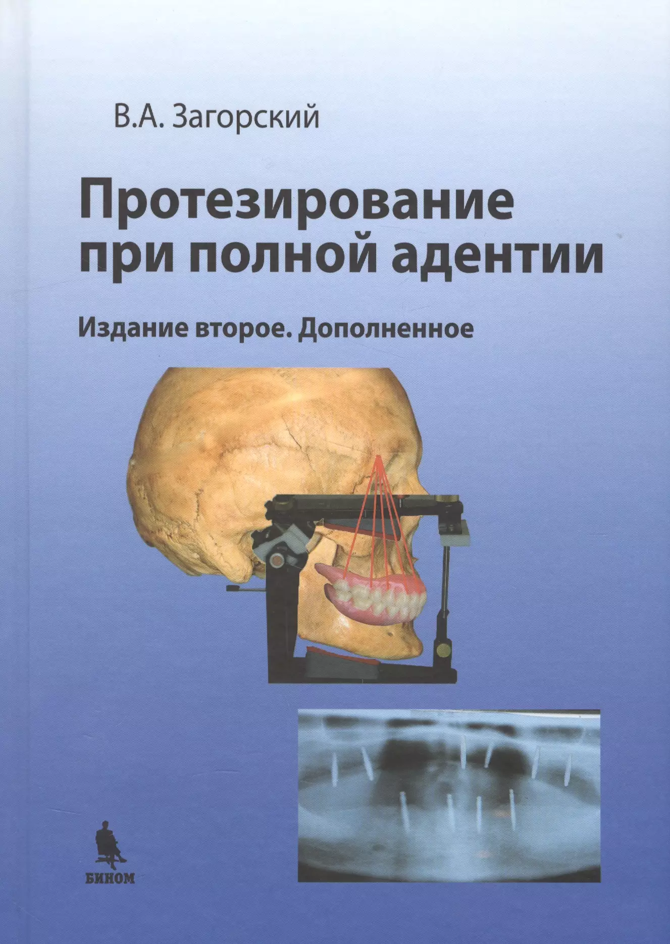 Загорский Валерий Арсентьевич - Протезирование при полной адентии. Изд. 2-е, доп.