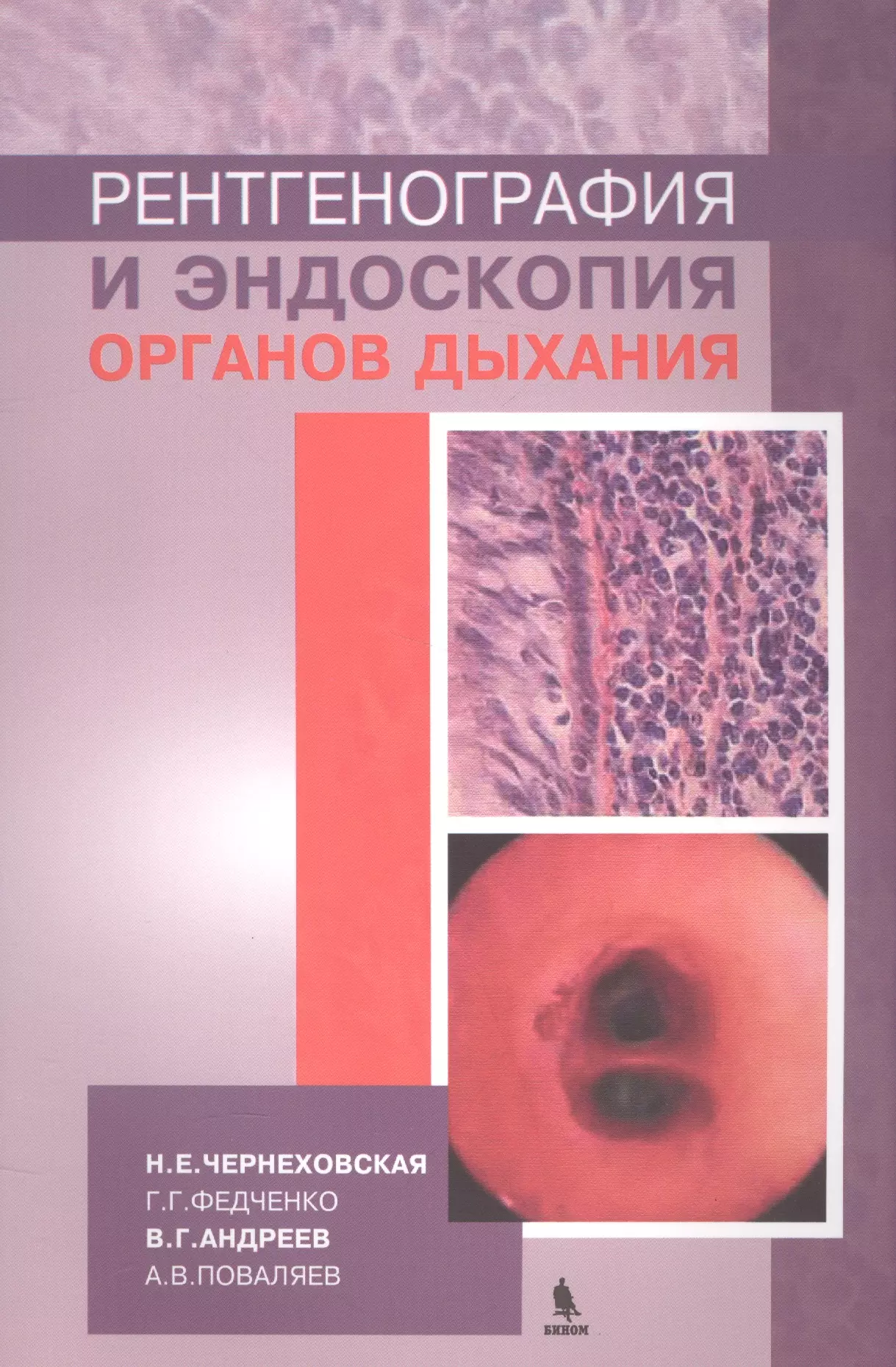 Чернеховская Наталья Евгеньевна - Рентгенография и эндоскопия органов дыхания