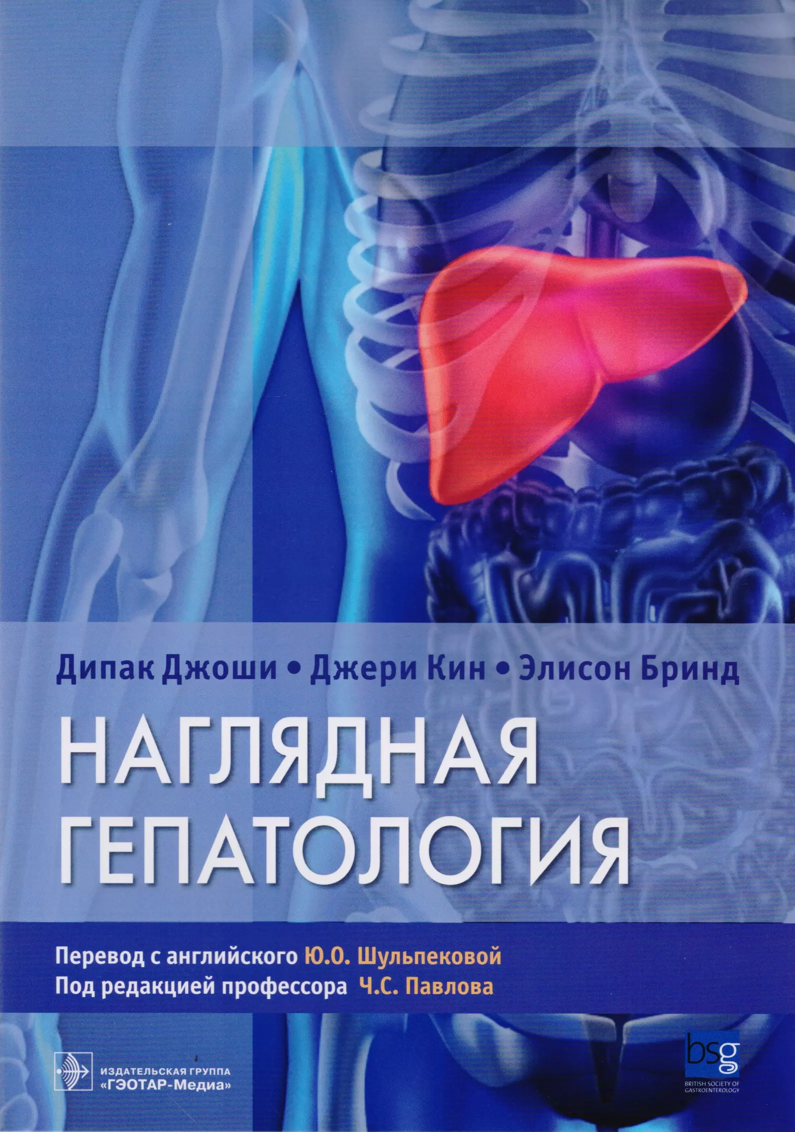 Гепатология сегодня. Наглядная гепатология. Книги про медицину. Гепатология книги. Наглядные пособия по гастроэнтерологии.