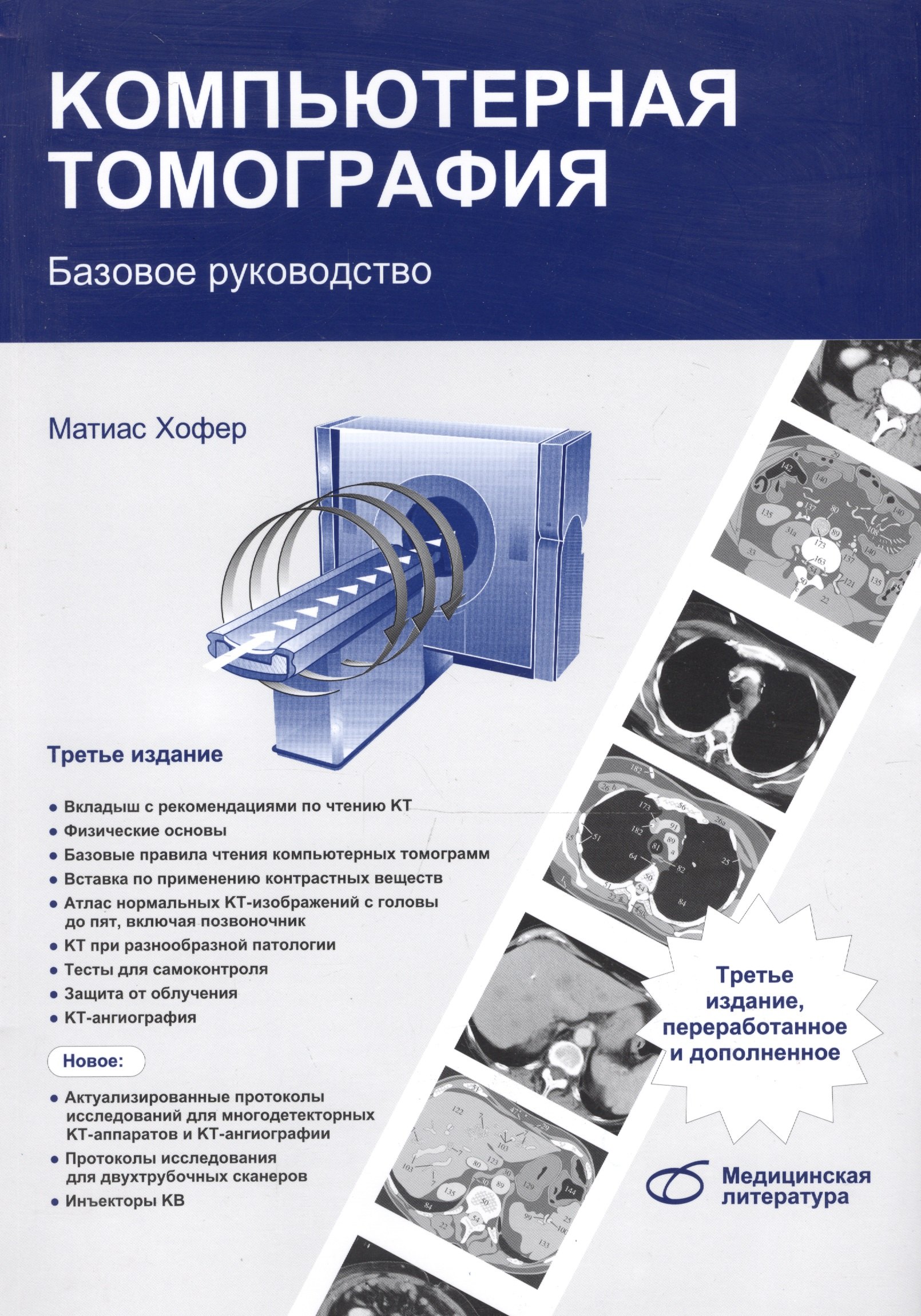 

Компьютерная томография Базовое руководство