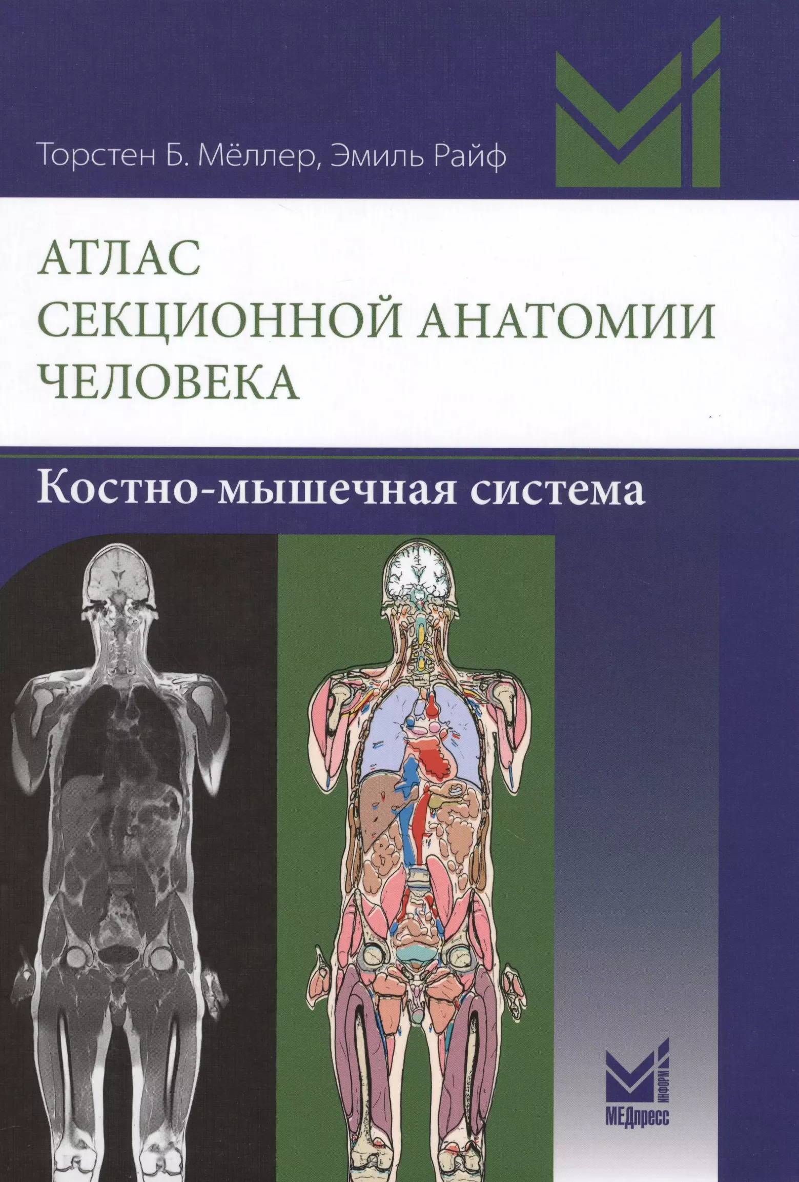 Атлас секционной анатомии. Атлас секционной анатомии Меллер. Атлас секционной анатомии человека. Костно-мышечная система. Атлас секционной анатомии Меллер шея. Секционная анатомия Меллер.