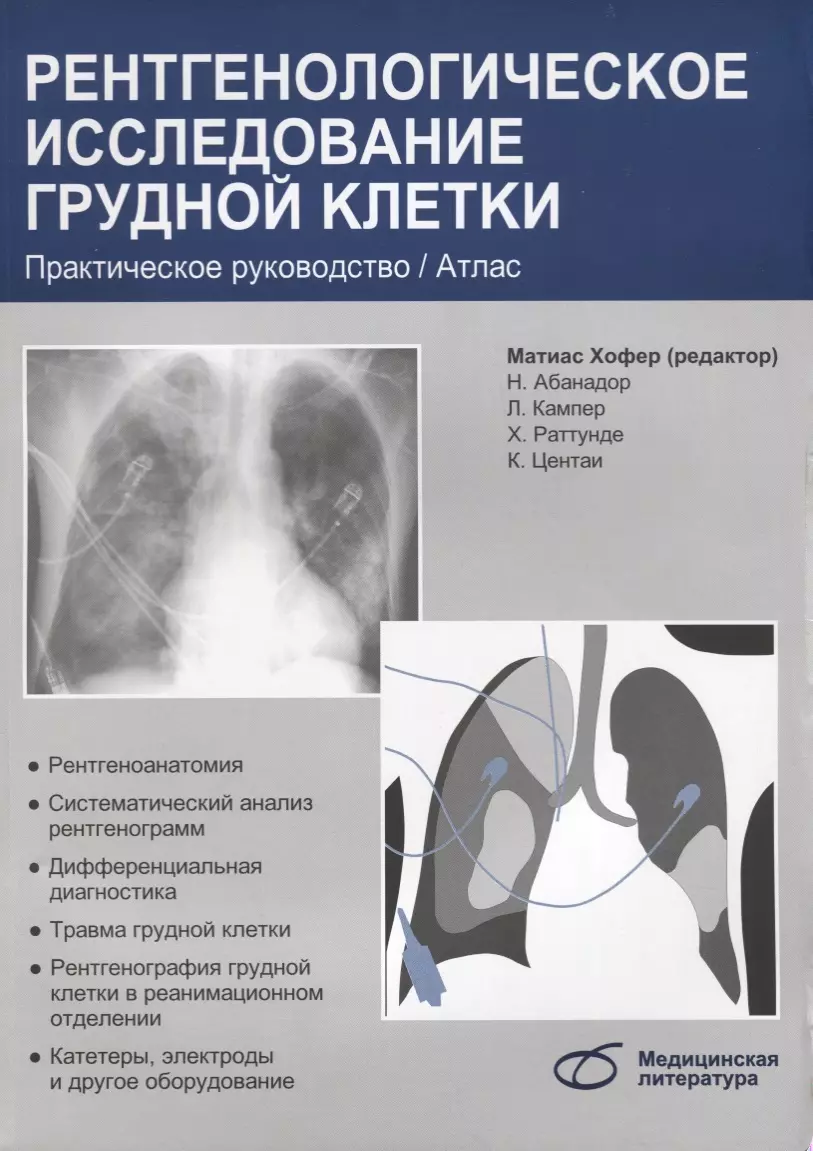 Рентгенологическое обследование грудной клетки