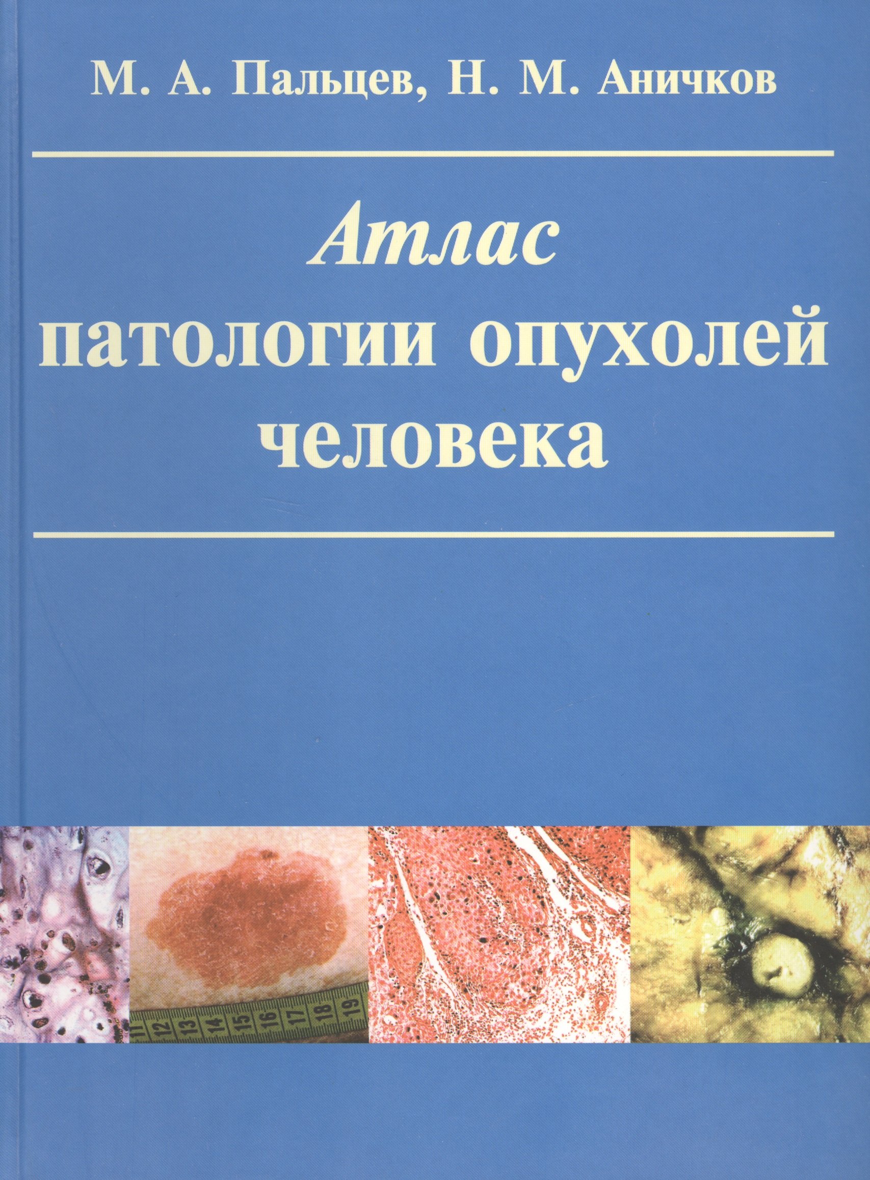 

Атлас патологии опухолей человека