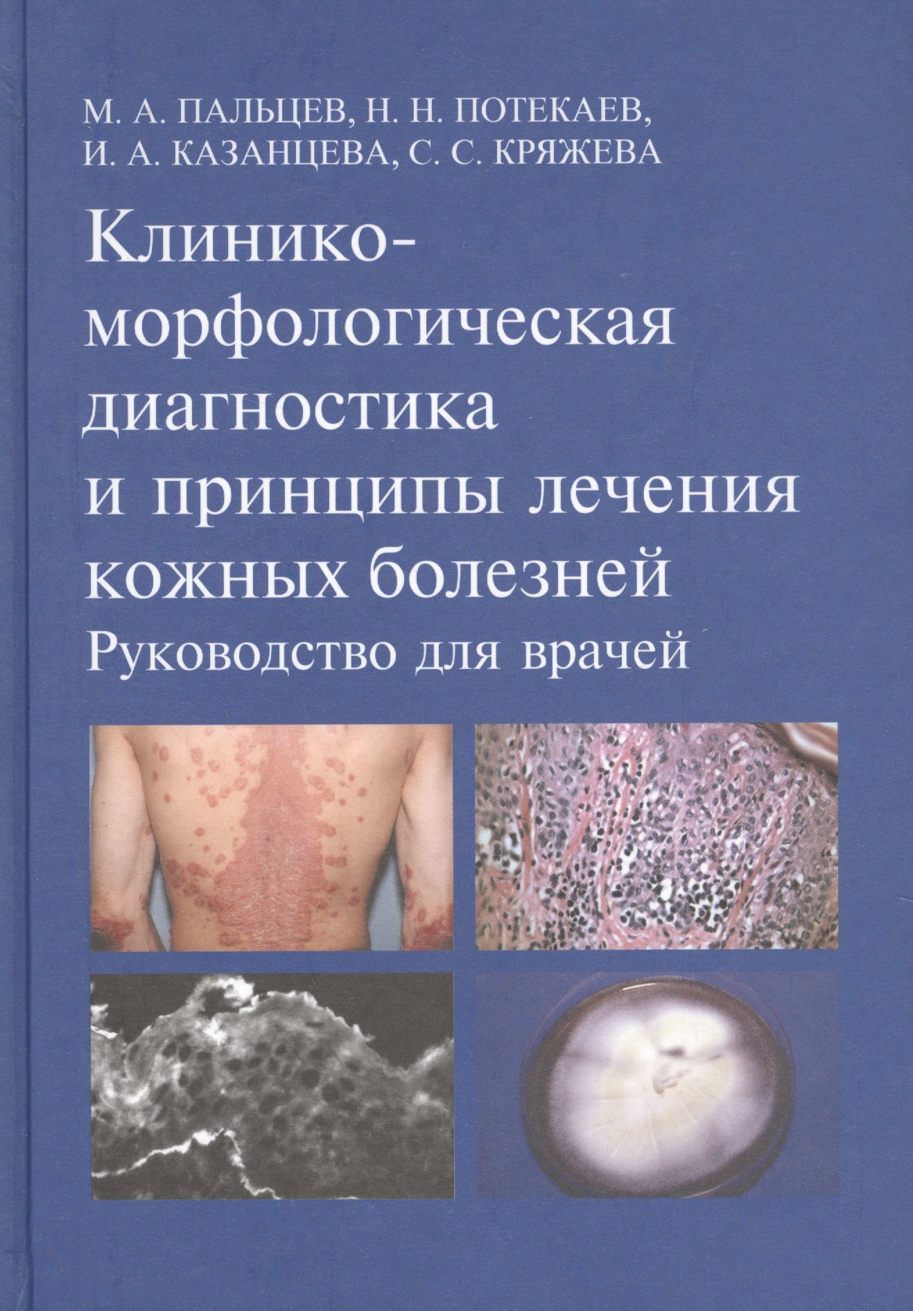 

Клинико-морфологическая диагностика и принципы лечения кожных болезней. Руководство для врачей