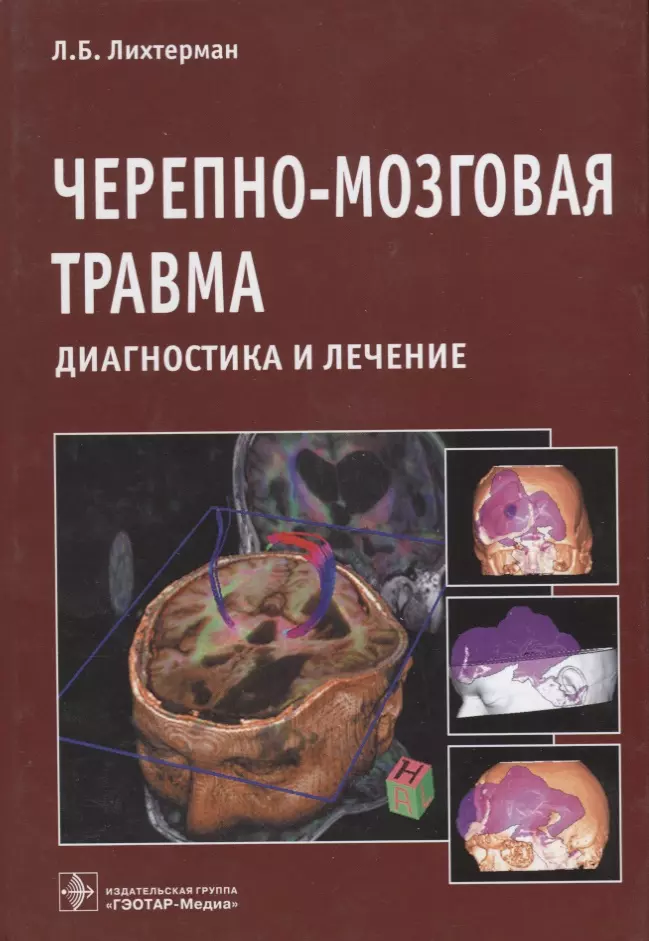 Издательство гэотар медиа. Черепно-мозговая травма. Леонид Лихтерман. Черепно-мозговая травма книга. Диагностика черепно-мозговой травмы.