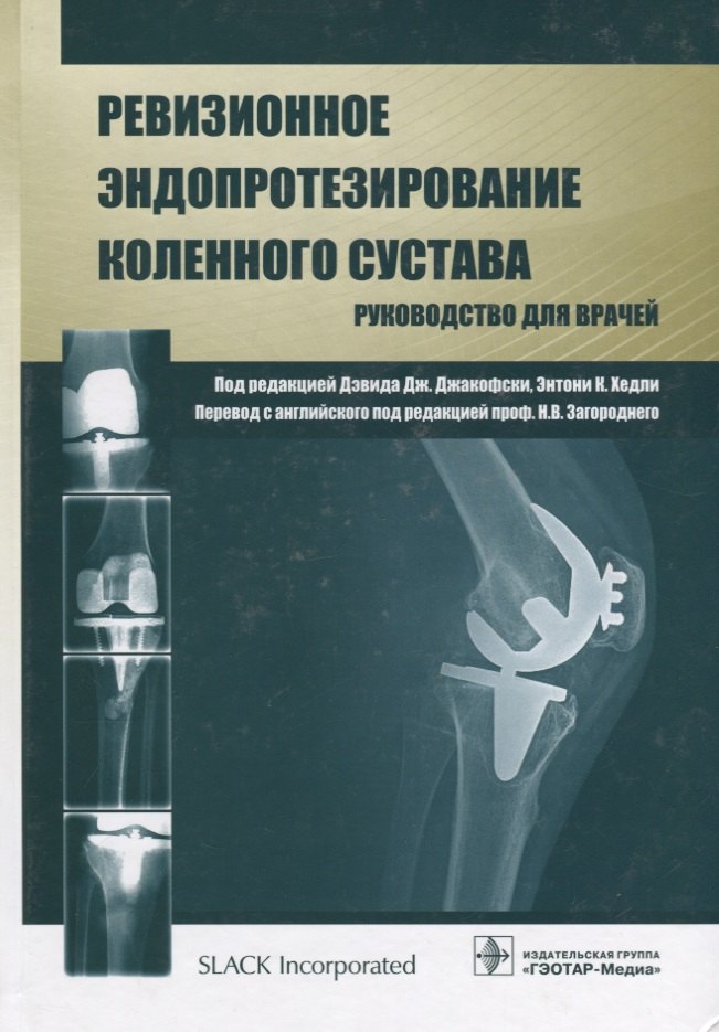 

Ревизионное эндопротезирование коленного сустава : руководство для врачей