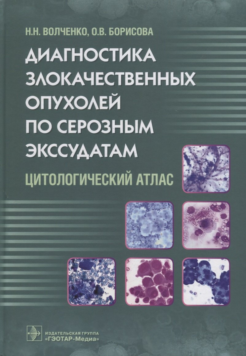 

Диагностика злокачественных опухолей по серозным экссудатам. 18г.