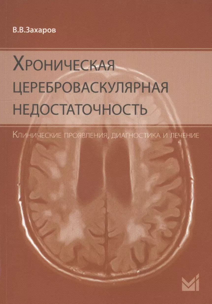 Цереброваскулярная болезнь. Хроническая цереброваскулярная недостаточность. Цереброваскулярная недостаточность головного мозга. Хроническая цереброваскулярная недостаточность диагноз. Препараты при цереброваскулярной недостаточности.