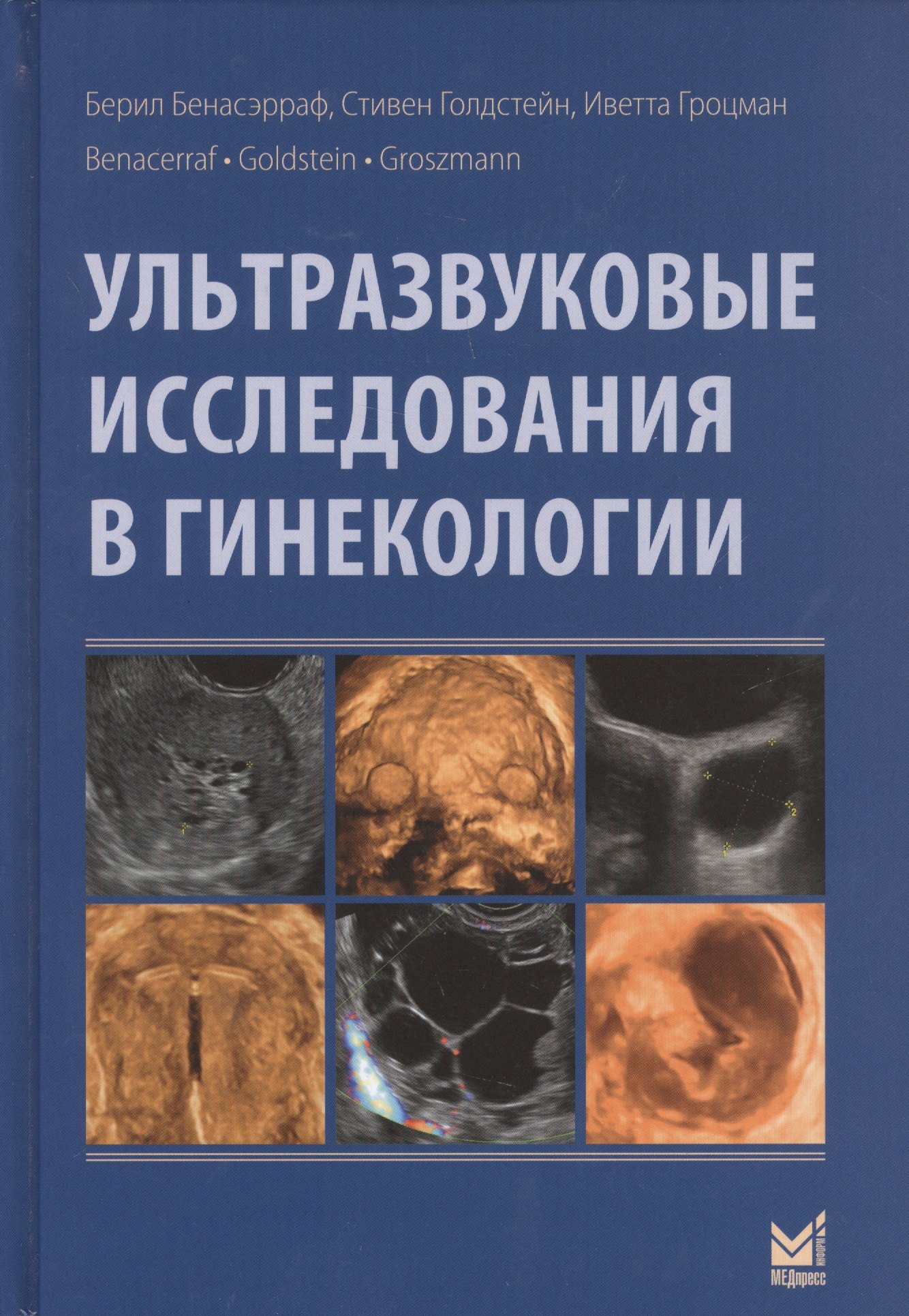 

Ультразвуковые исследования в гинекологии