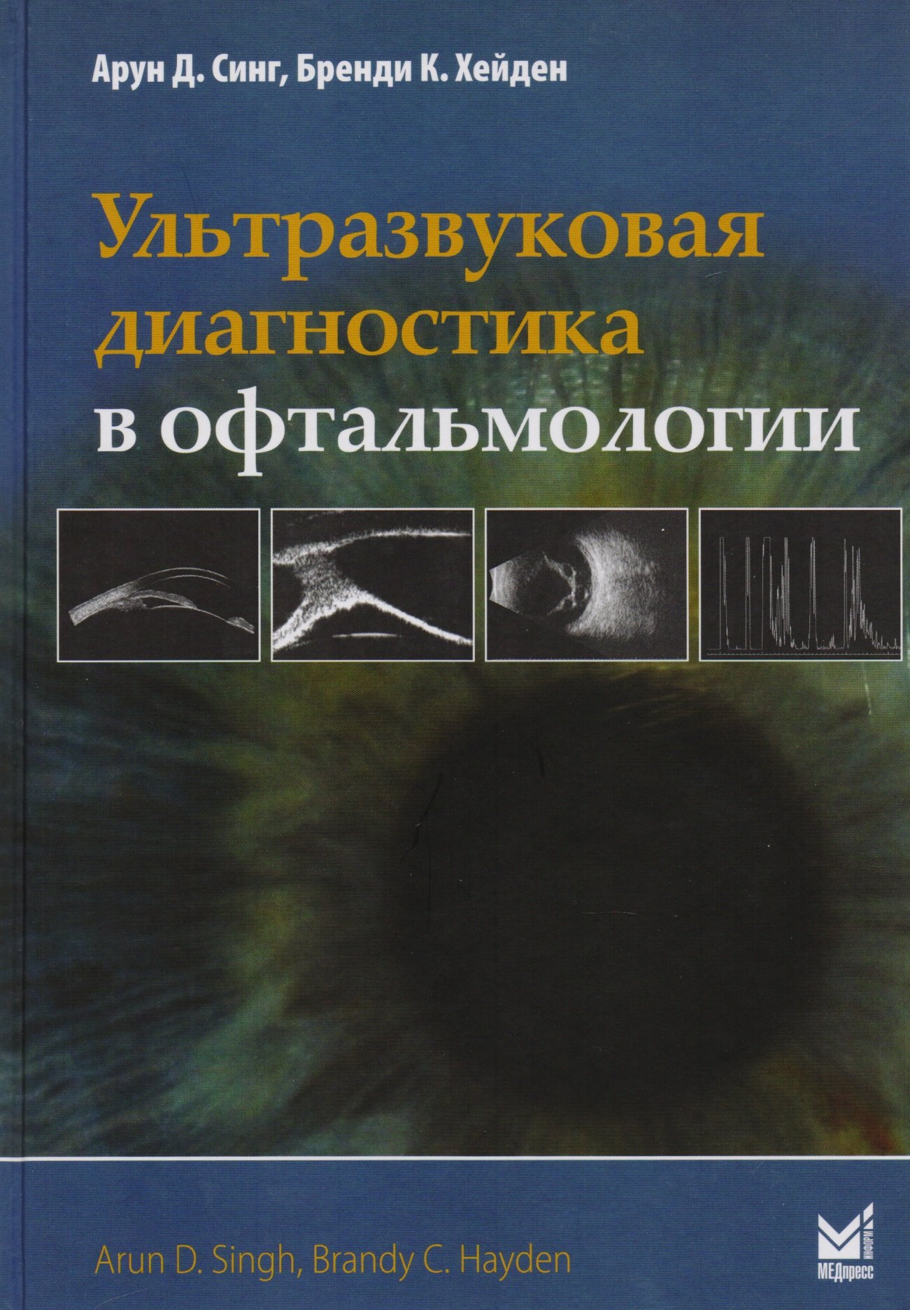 

Ультразвуковая диагностика в офтальмологии