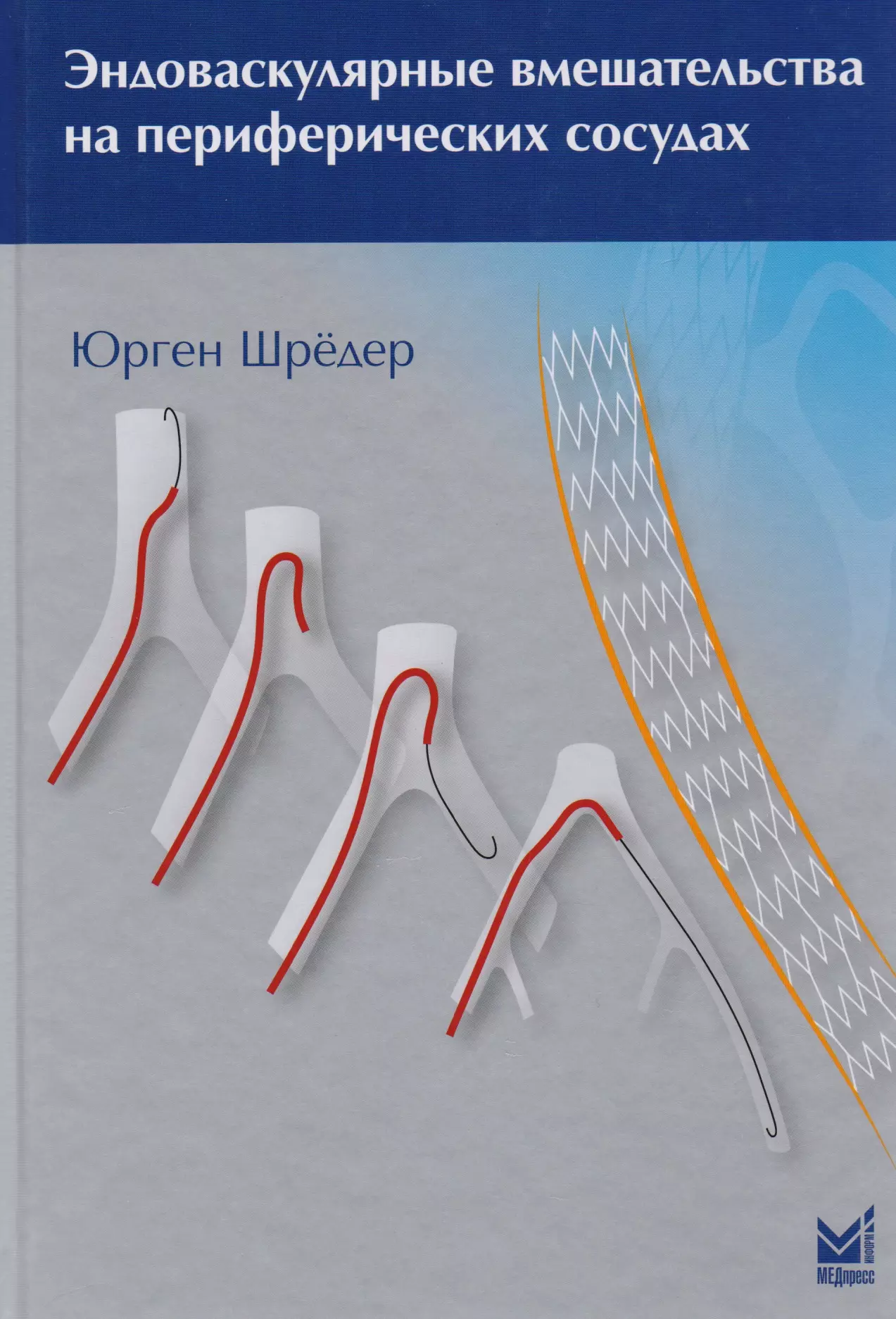 Периферические сосуды. Шредер ю. - эндоваскулярные вмешательства на периферических сосудах. Юрген шредер эндоваскулярные. Эндоваскулярные вмешательства на периферических сосудах. Инструменты для эндоваскулярной хирургии.