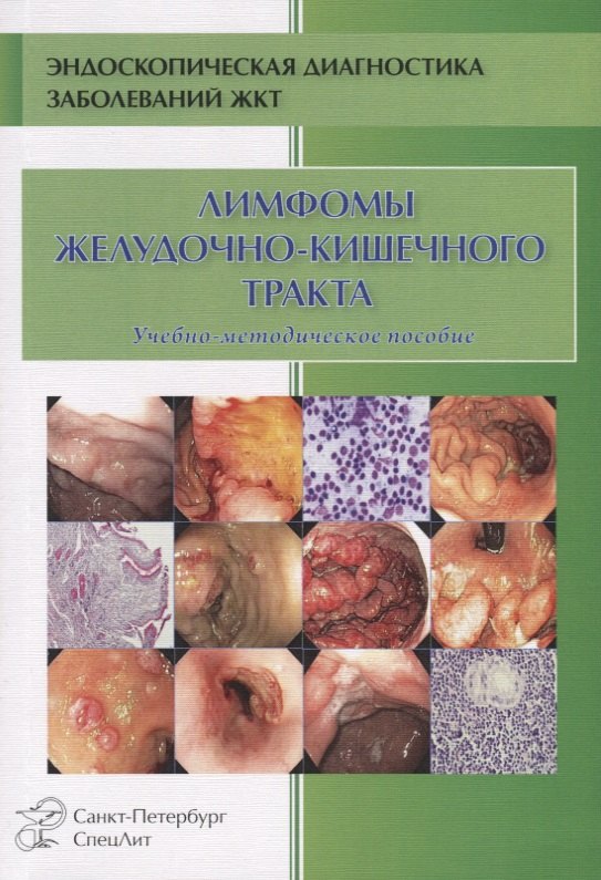 

Лимфомы ЖКТ