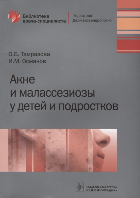  - Акне и малассезиозы у детей и подростков