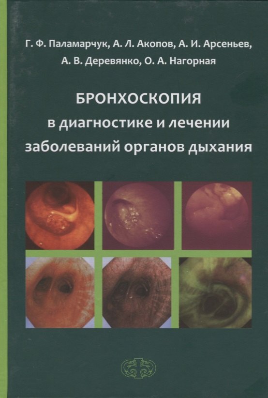 

Бронхоскопия в диагностике и лечении заболеваний органов дыхания