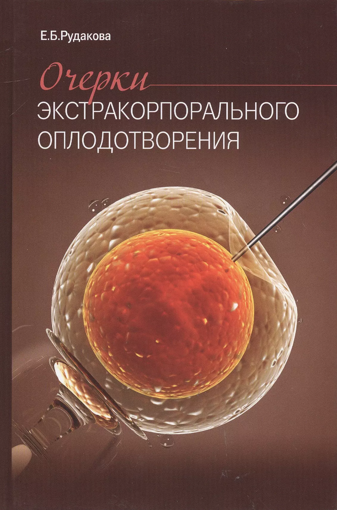 Рудакова Елена Борисовна, Рудакова Е. - Очерки экстракорпорального оплодотворения.