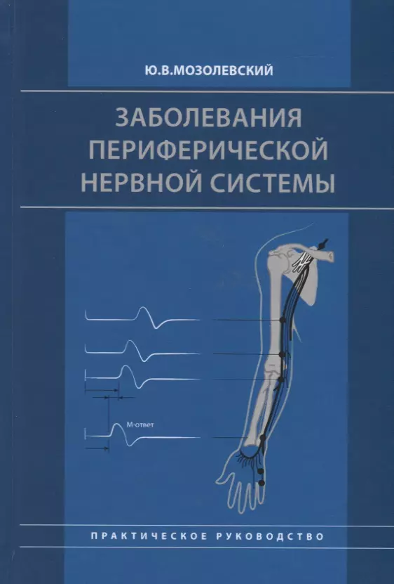  - Заболевания периферической нервной системы. Практическое руководство