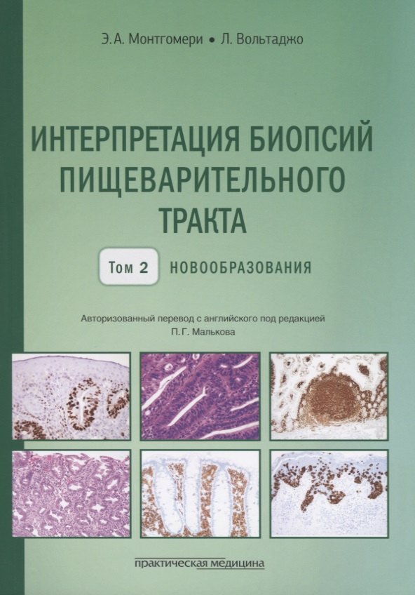 

Интерпретация биопсий пищеварительного тракта. Том 2. Новообразования