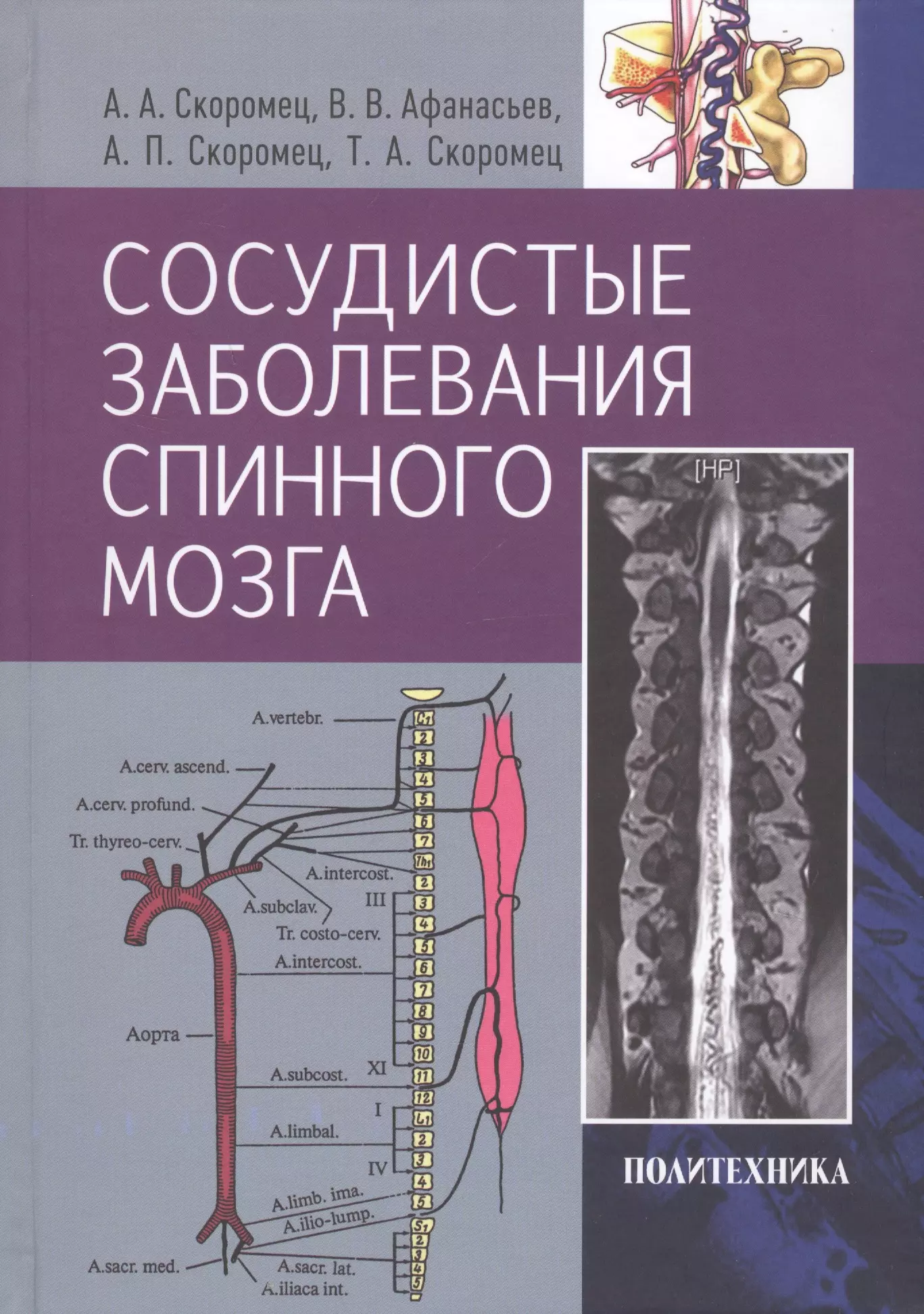  - Сосудистые заболевания спинного мозга. Руководство для врачей