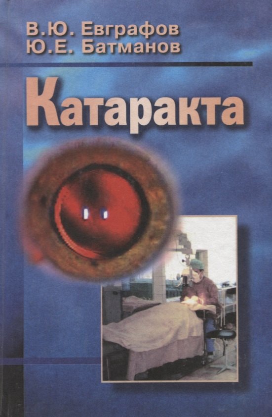 

Катаракта