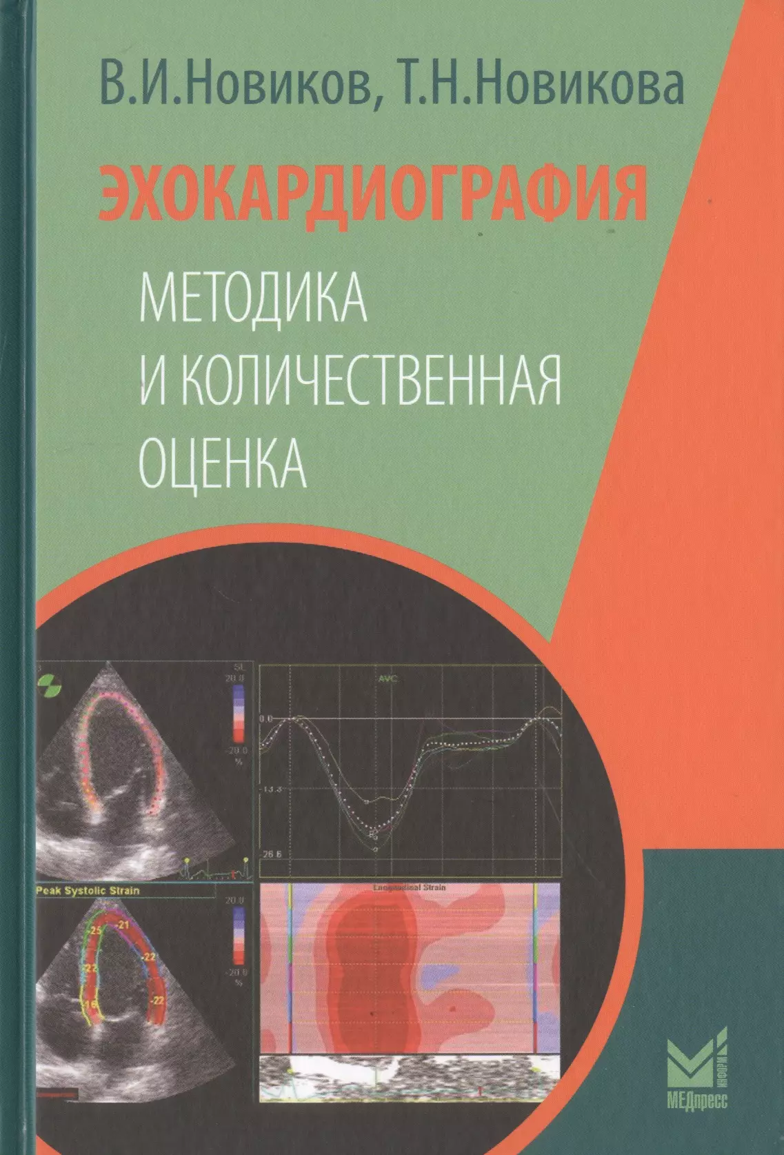 Новиков Владимир Игоревич - Эхокардиография. Методика и количественная оценка