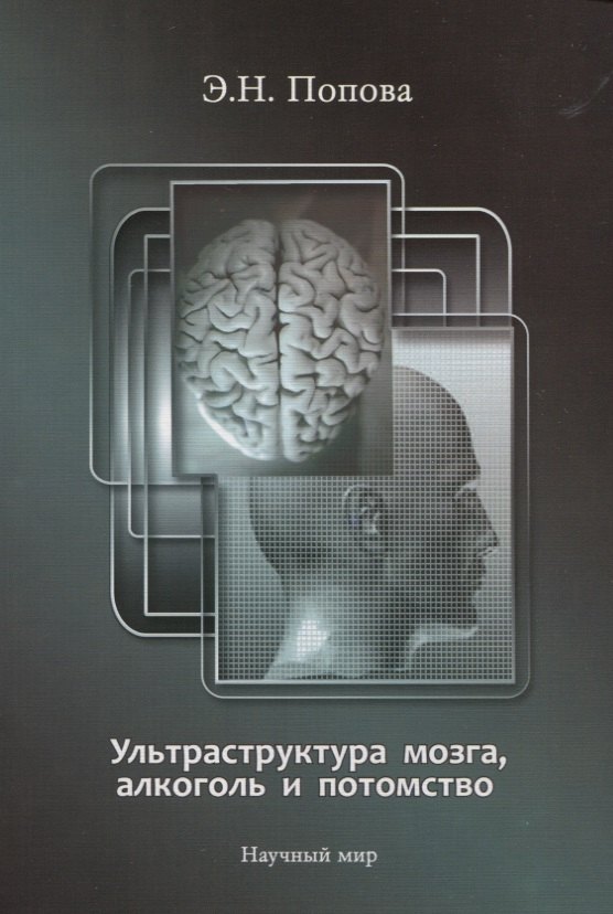 

Ультраструктура мозга, алкоголь и потомство