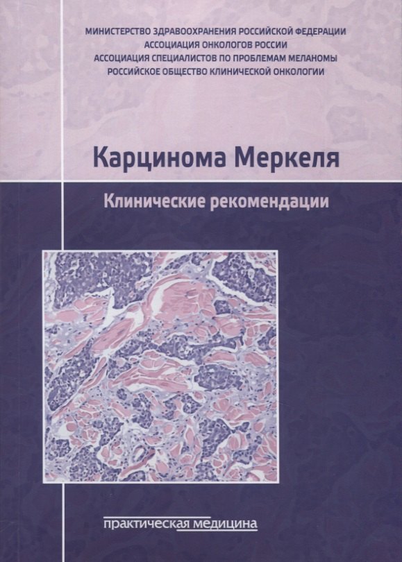 

Карцинома Меркеля. Клинические рекомендации