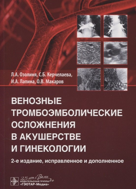 

Венозные тромбоэмболические осложнения в акушерстве и гинекологии