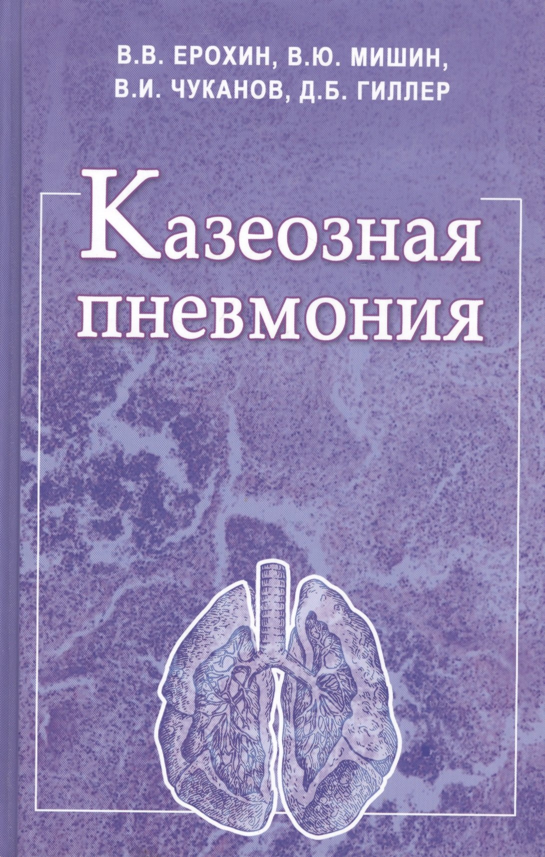 

Казеозная пневмония. Руководство для врачей