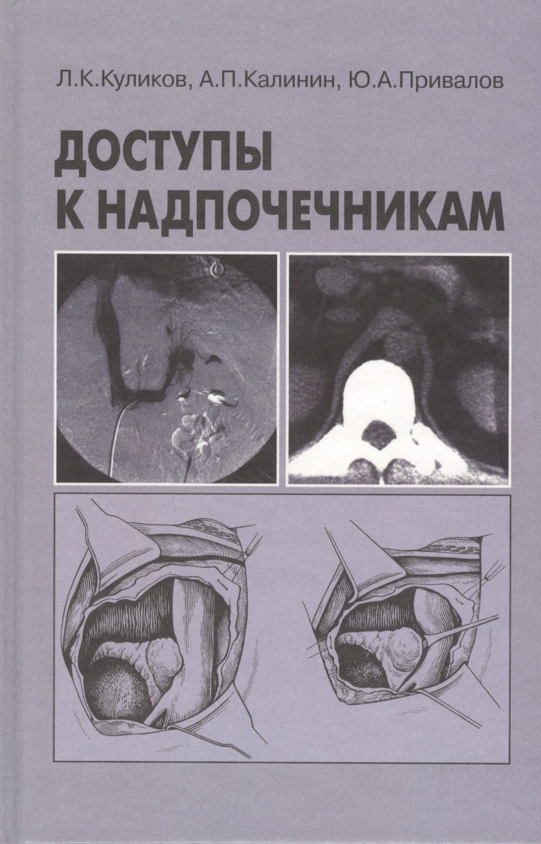 

Доступы к надпочечникам. Руководство для врачей