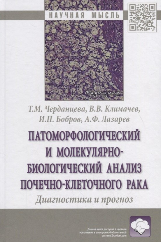 

Патоморфологический и молекулярно-биологический анализ почечно-клеточного рака. Диагностика и прогноз. Монография