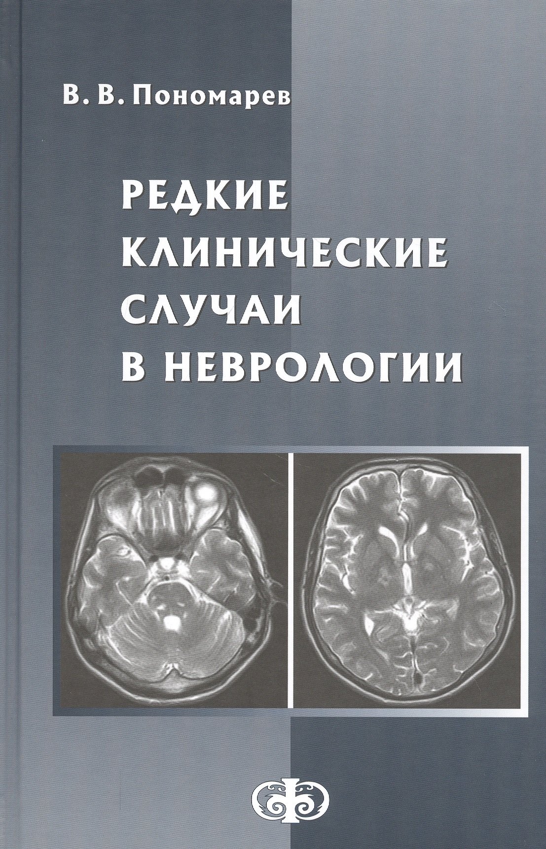 

Редкие клинические случаи в неврологии. Руководство для врачей
